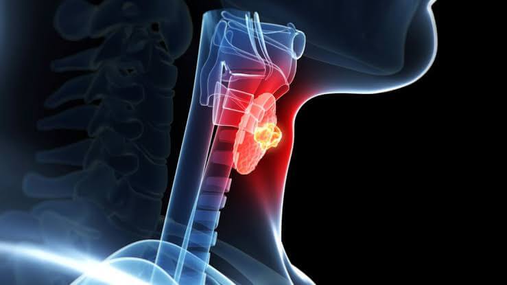 Know about TSH test if you have thyroid