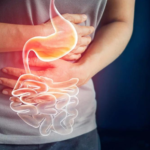 https://fitnessproguru.com/healthy-diet/25-common-foods-and-factors-that-can-trigger-acid-reflux/